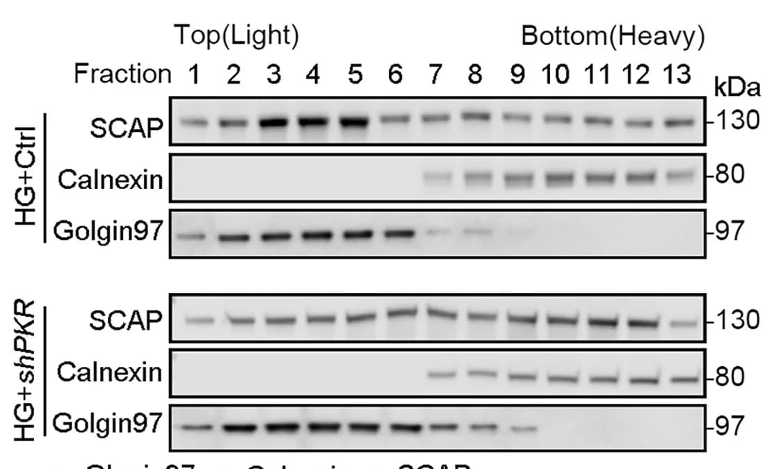 Open access visualization of Gel, Cell Homogenization, Cell Fractionation, Gradient Centrifugation, Immunoblotting