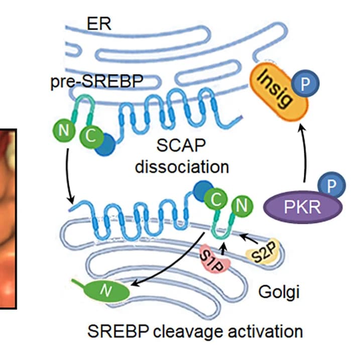 Open access visualization of Workflow, Flowchart, Illustration, SREBP Cleavage, PKR