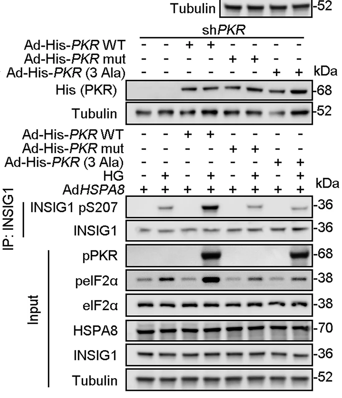 Open access visualization of Gel, Cell Lysates, CoIP, INSIG1 Antibody, Western Blotting