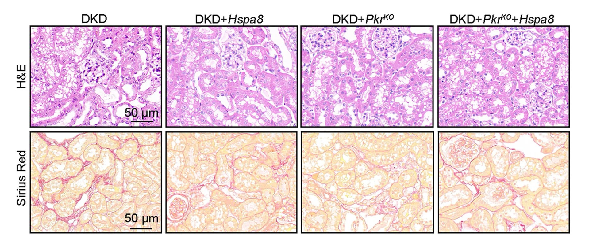 Open access visualization of Microscopy, Sirius Red Staining, H&E Staining, Kidney Sections, Histology