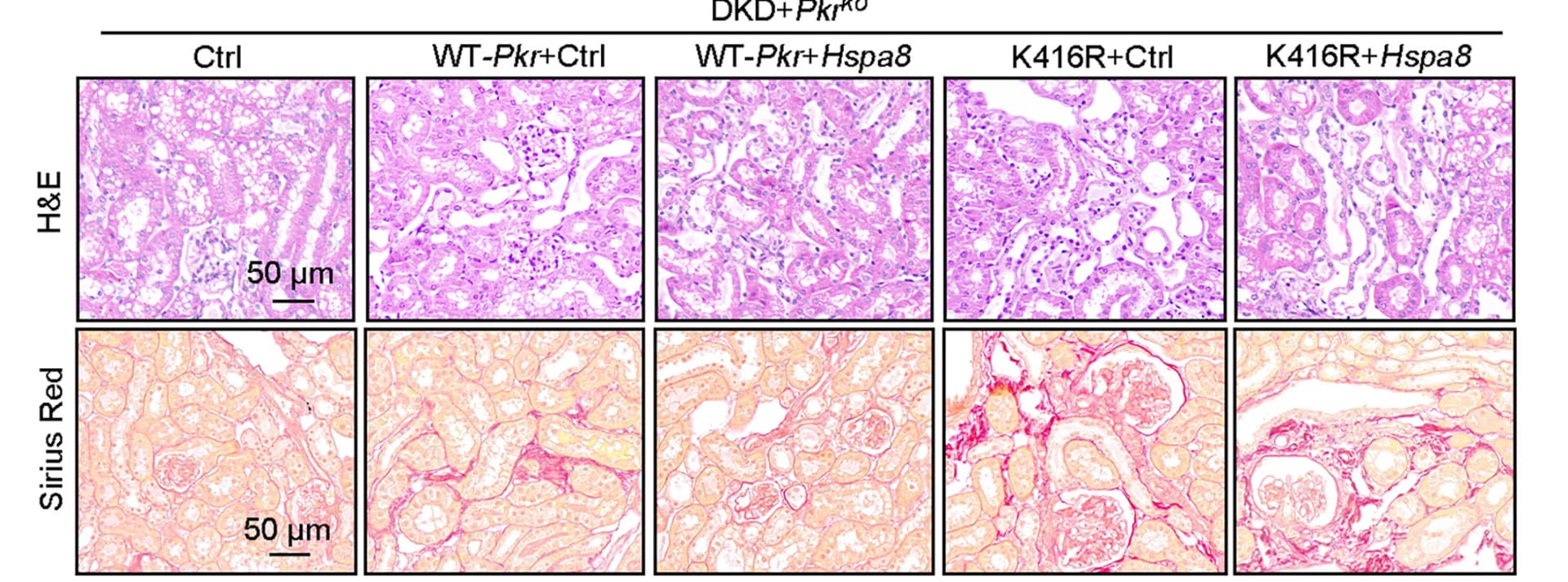 Open access visualization of Microscopy, Sirius Red Staining, H&E Staining, Kidney Sections, Histology