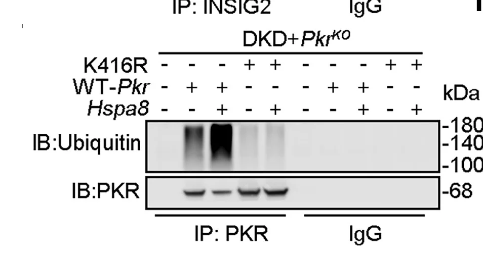 Open access visualization of Gel, Kidney Lysates, CoIP, PKR Antibody, Western Blotting