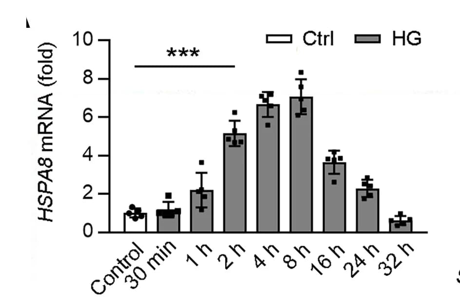Open access visualization of Bar Plot, Error Bars, mRNA, qPCR, HSPA8