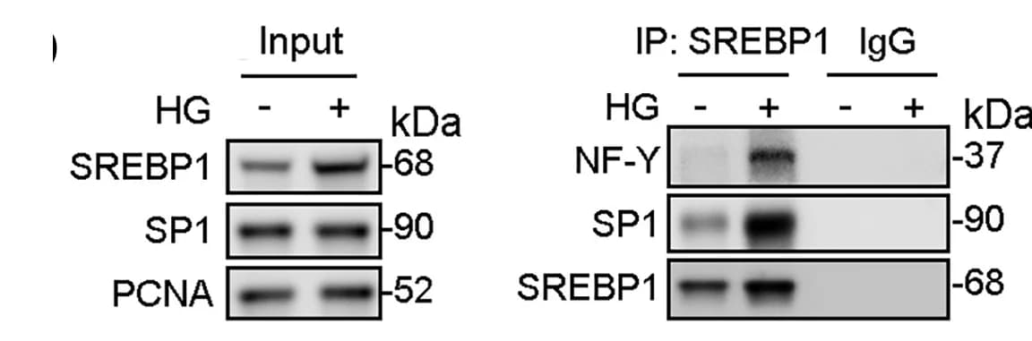 Open access visualization of Gel, Cell Lysates, coIP, SREBP1 Antibody, Western Blotting