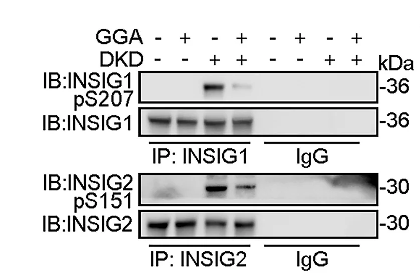Open access visualization of Gel, Kidney Lysates, coIP, INSIG1 Antibody, INSIG2 Antibody