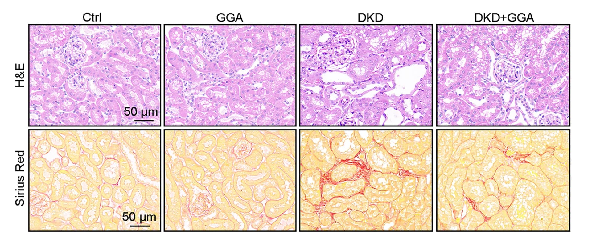 Open access visualization of Microscopy, Sirius Red Staining, H&E Staining, Kidney Sections, Histology