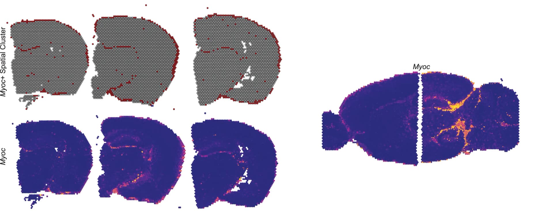 Open access visualization of Heatmap, Spatial Transcriptomics, Brain Regions, Myocilin, Transcriptomic Tissue