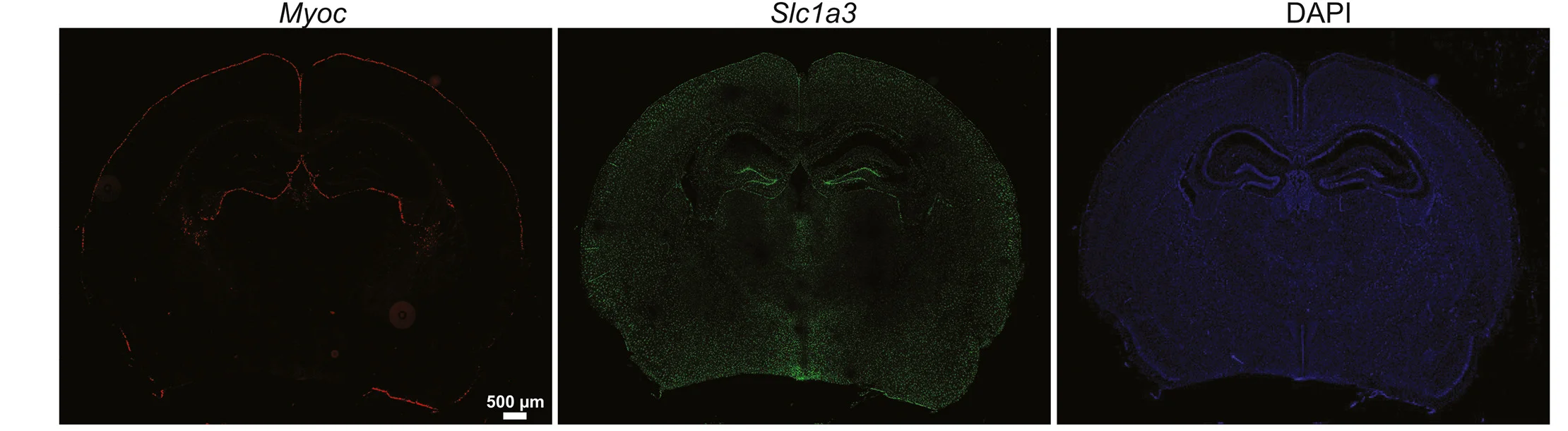 Open access visualization of Microscopy, RNA In Situ Hybridization, Myoc, Astrocyte Marker, Slc1a3