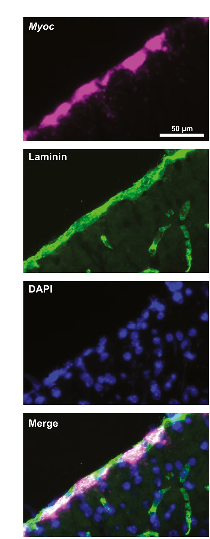 Open access visualization of Microscopy, RNAscope, Myoc, Immunohistochemistry, Extracellular Matrix Protein