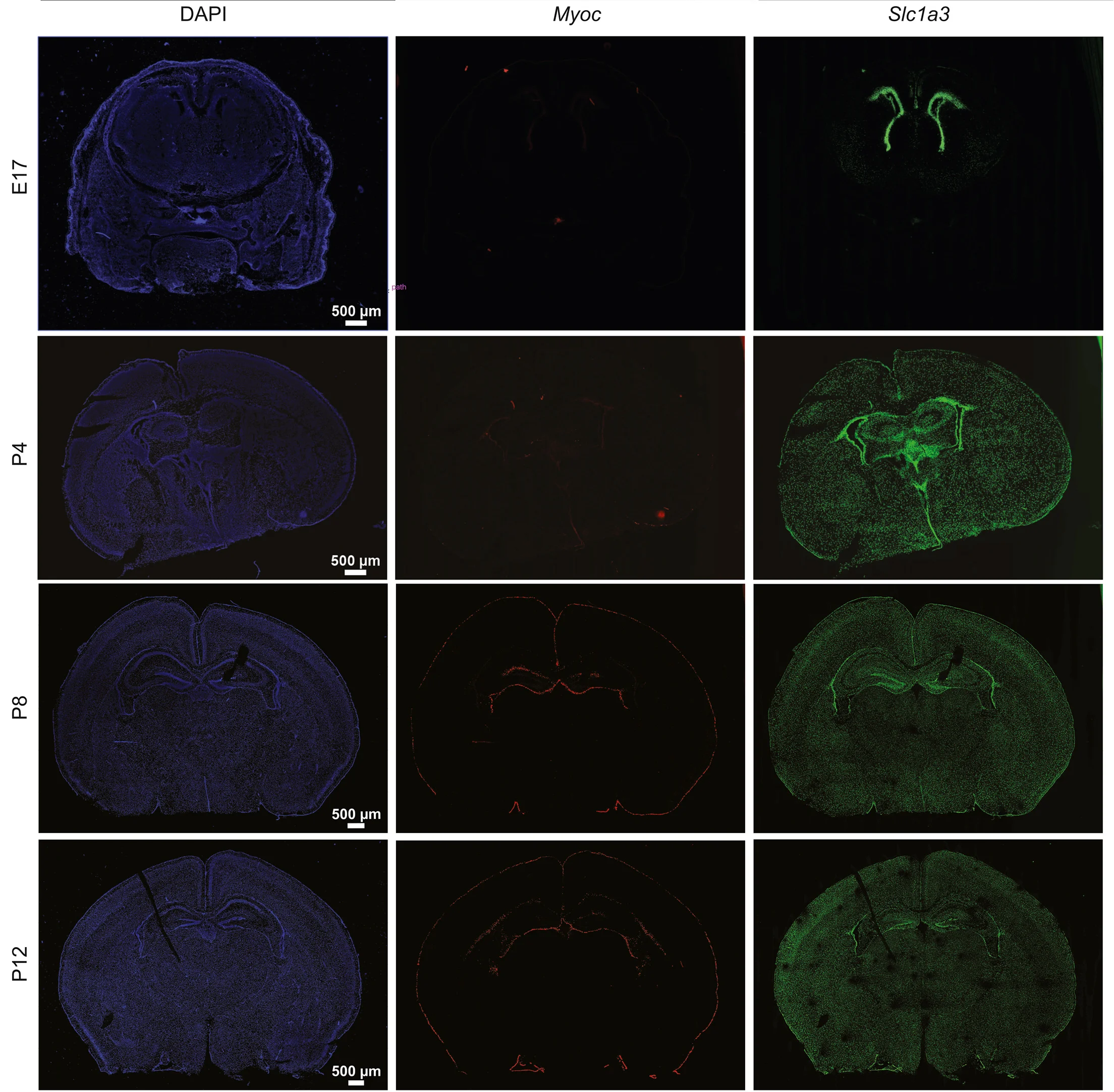 Open access visualization of Microscopy, In Situ Hybridizations, Myoc, Astrocyte Marker, Slc1a3
