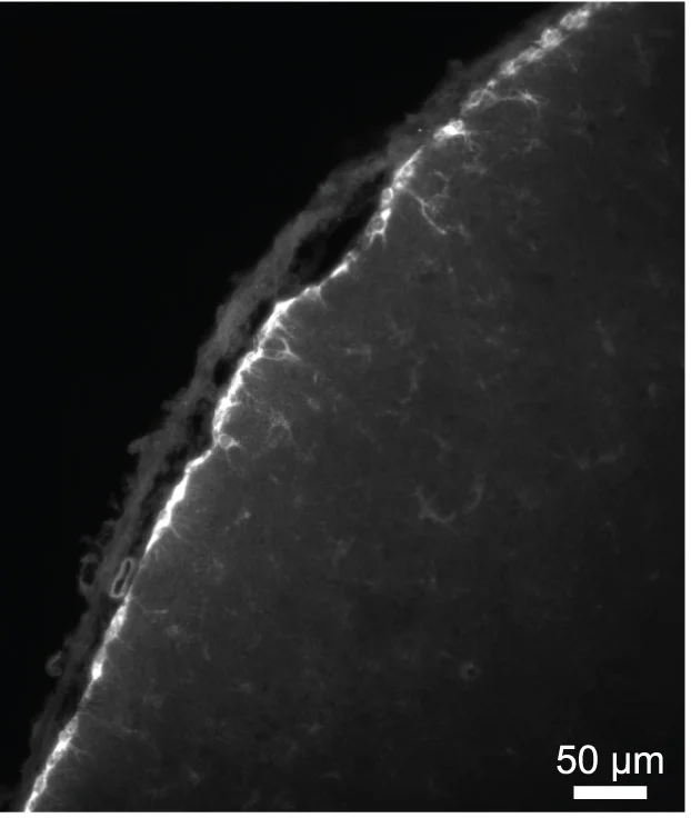 Open access visualization of Microscopy, AdipoClear, Aldh1l1eGFP Brains, Light-Sheet Microscopy, Astrocyte Cell Bodies