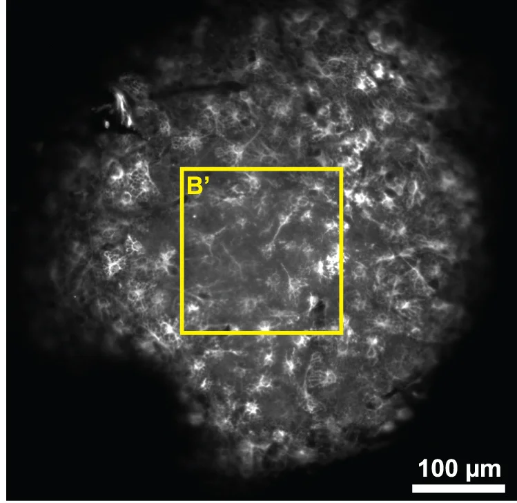 Open access visualization of Microscopy, GLS Astrocytes, Cortical Surface, Cell Bodies, Processes