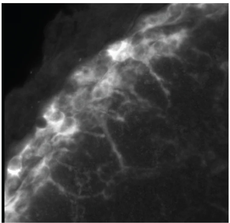 Open access visualization of Microscopy, GLS Astrocytes, Cell Bodies, Cortical Surface, Branched Processes