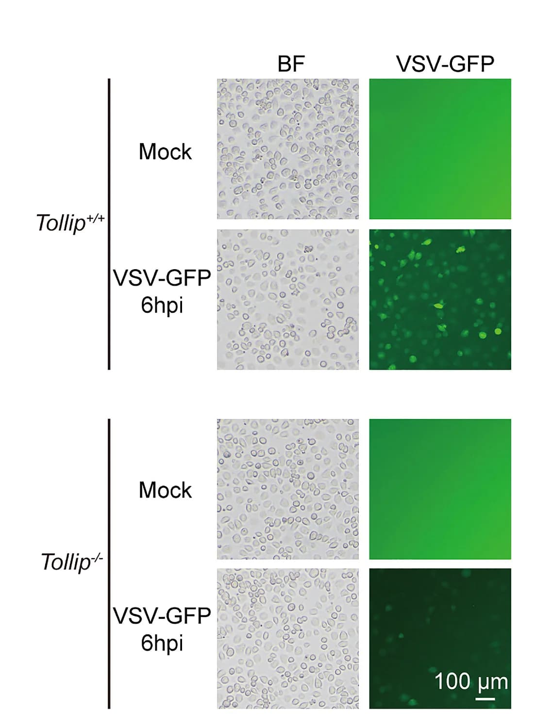 Open access visualization of Microscopy, Fluorescence Microscopy, VSV-GFP Replication, Tollip+/+ Peritoneal Macrophages, Tollip-/- Peritoneal Macrophages