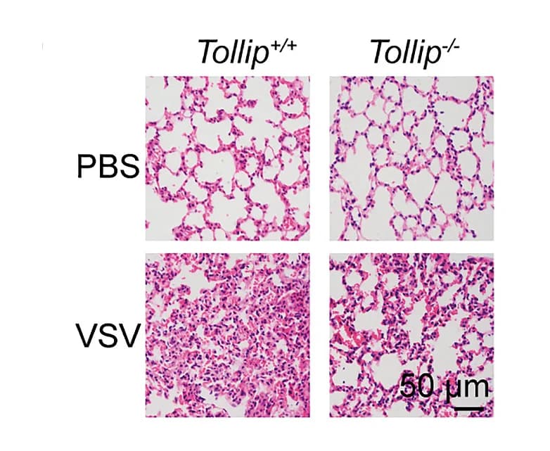 Open access visualization of Microscopy, Hematoxylin and Eosin Staining, Lung Sections