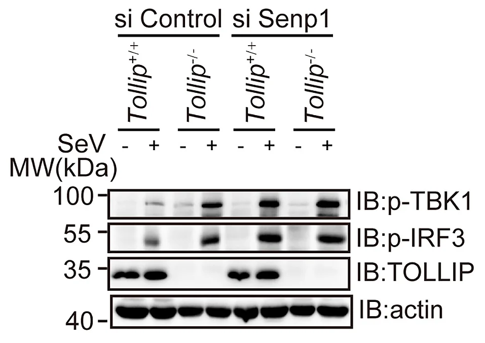 Open access visualization of Gel, Immunoblot, TBK1, p-TBK1, IRF3