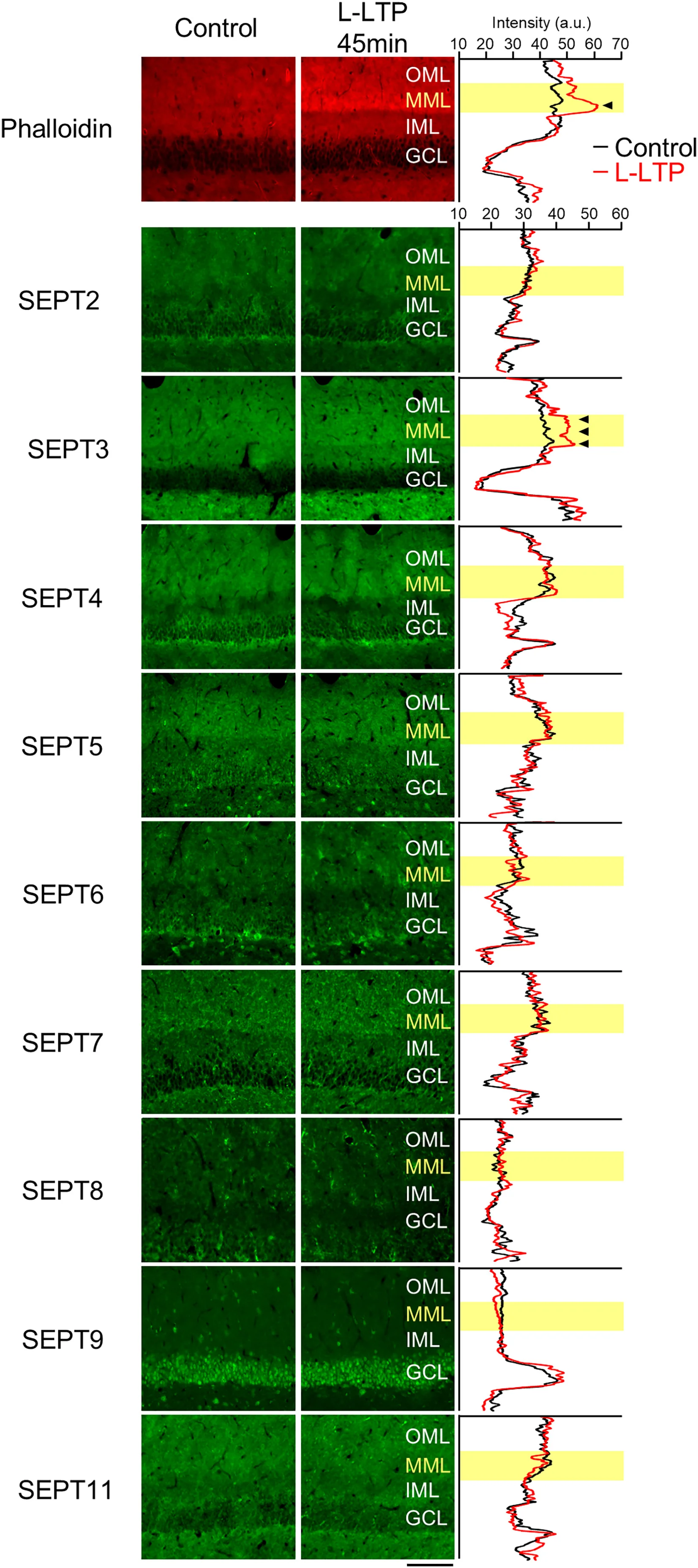 Open access visualization of Microscopy, Line Plot, Phalloidin, Antibodies, Septin Subunit