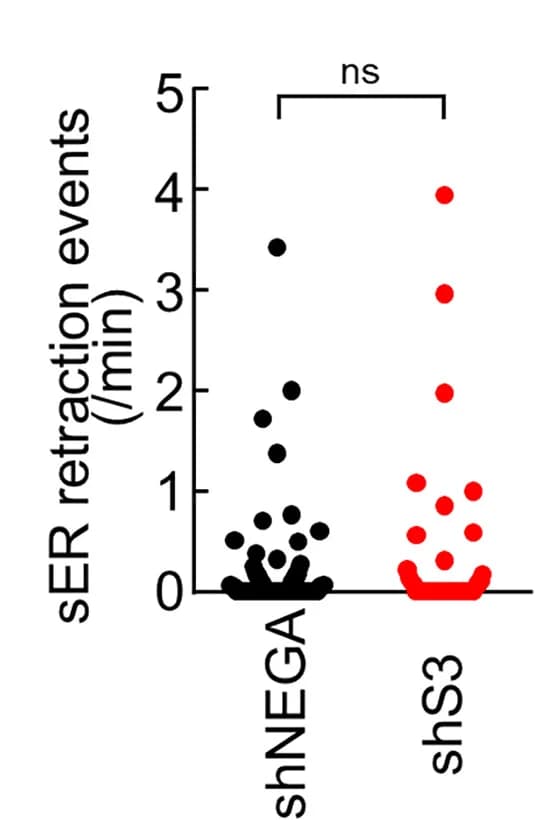 Open access visualization of Scatter Plot, Spine, sER, Retractions, Frequency