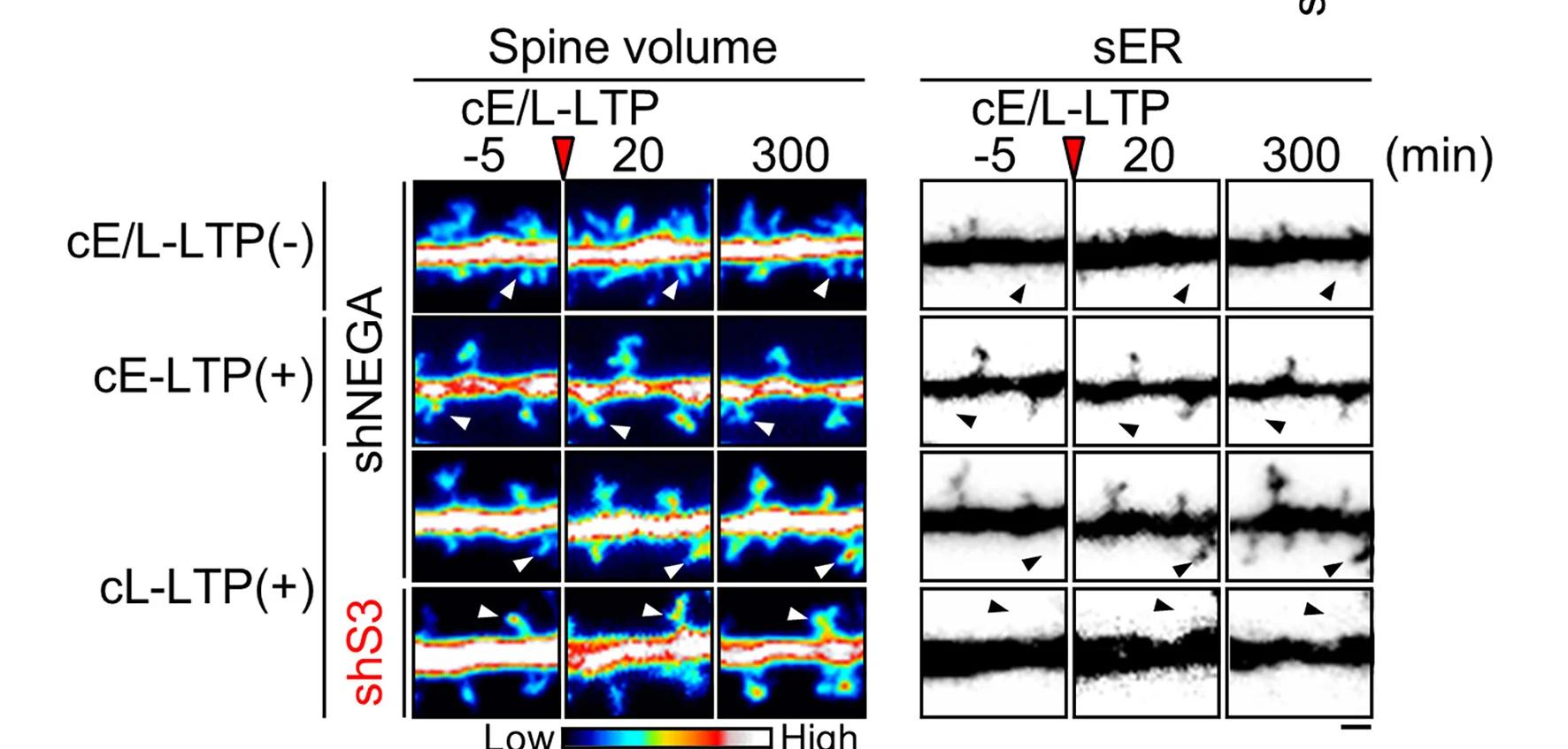 Open access visualization of Microscopy, Spines, sER, Control, SEPT3 Knockdown