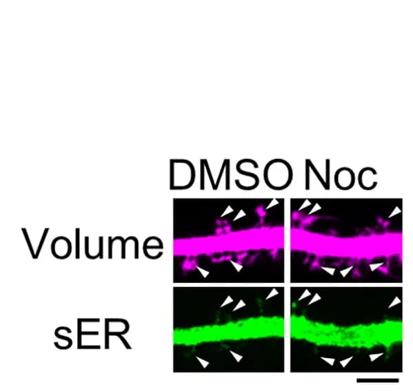 Open access visualization of Microscopy, Spines, sER, Cultured DGCs, Vehicle