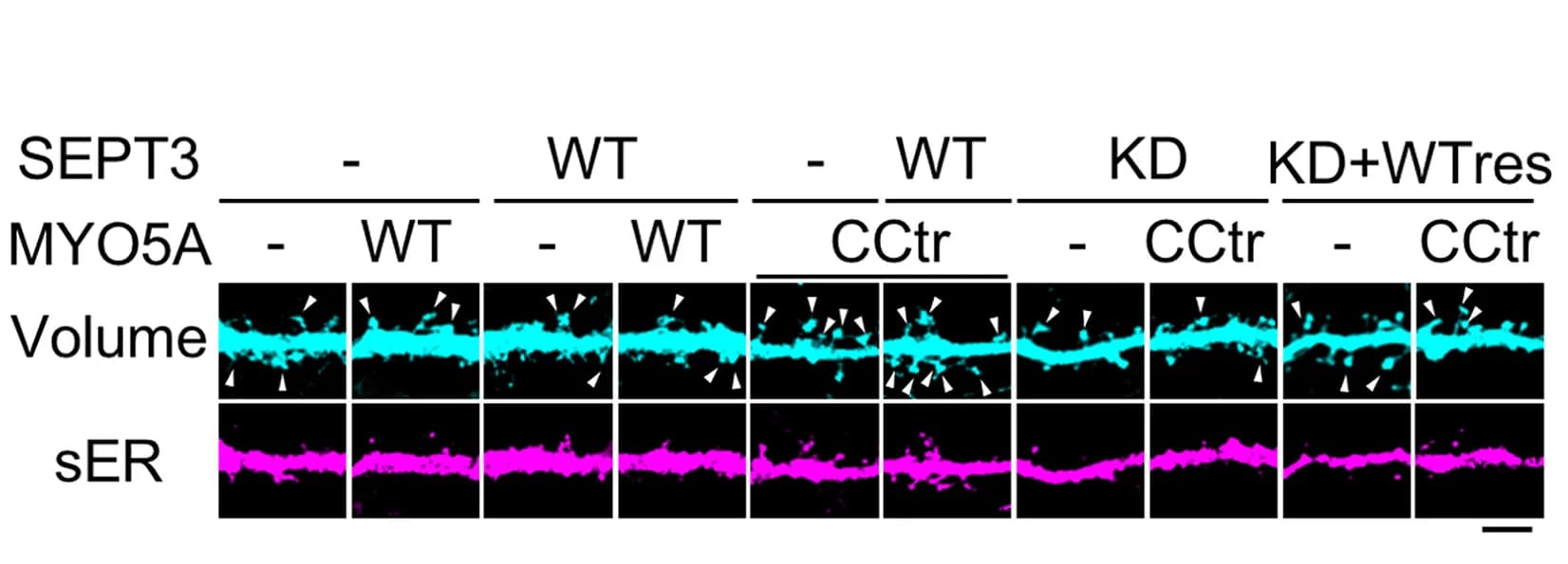 Open access visualization of Microscopy, MYO5A-WT, MYO5A-CCtr, SEPT3, DGCs