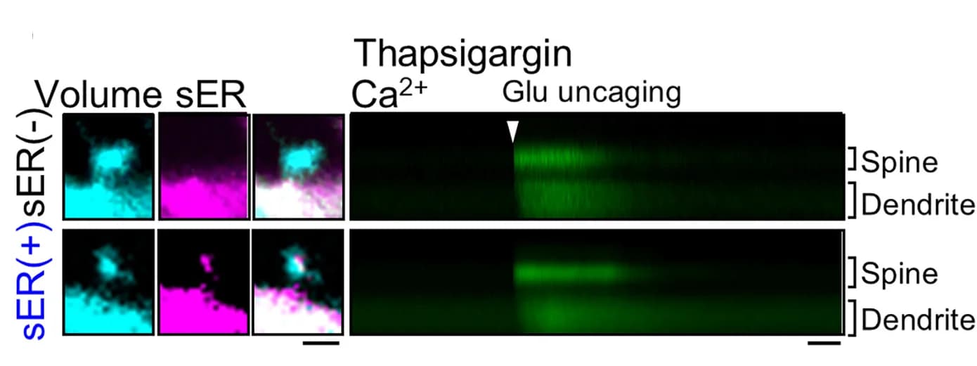 Open access visualization of Microscopy, GCaMP6f Fluorescence, Spine, SER, GLU uncaging