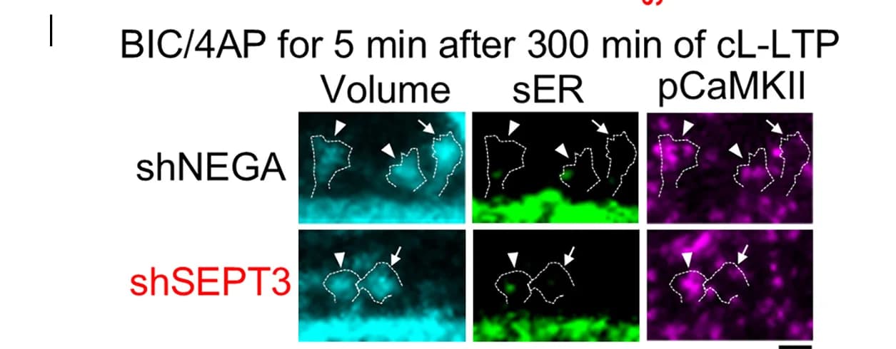 Open access visualization of Microscopy, Spines, SER, pCaMKII, Control Neurons