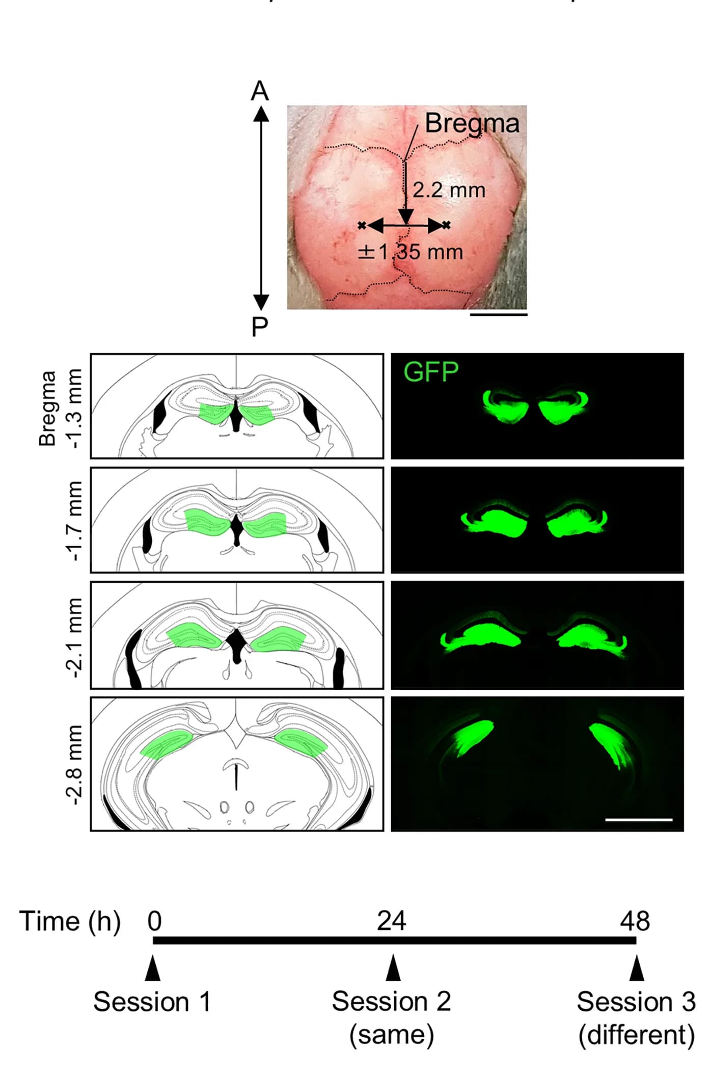 Open access visualization of Microscopy, Illustration, AAV-GFP Infection, Hippocampal DG Area, Wild-Type Mouse