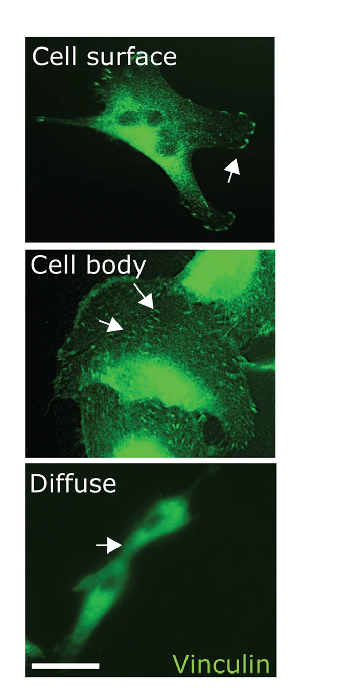 Open access visualization of Microscopy, Focal Adhesions, Cell Surface, Cell Body, Diffuse Distribution