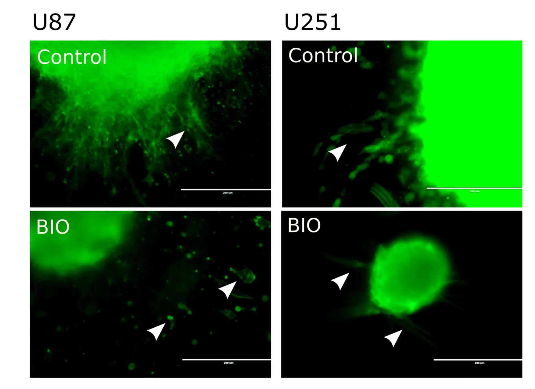 Open access visualization of Microscopy, BIO Treatment, Migrating U87 Cells, Cell Protrusions, Elongated Cells