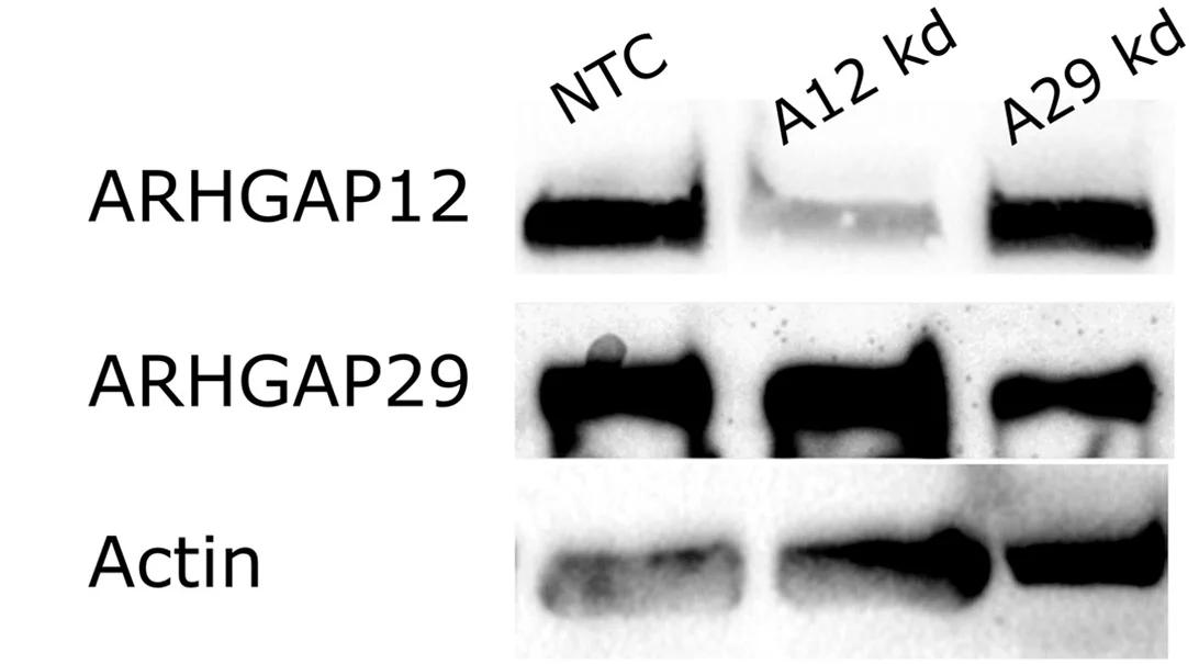 Open access visualization of Gel, Gene Silencing, ARHGAP12, ARHGAP29, U251 Cells