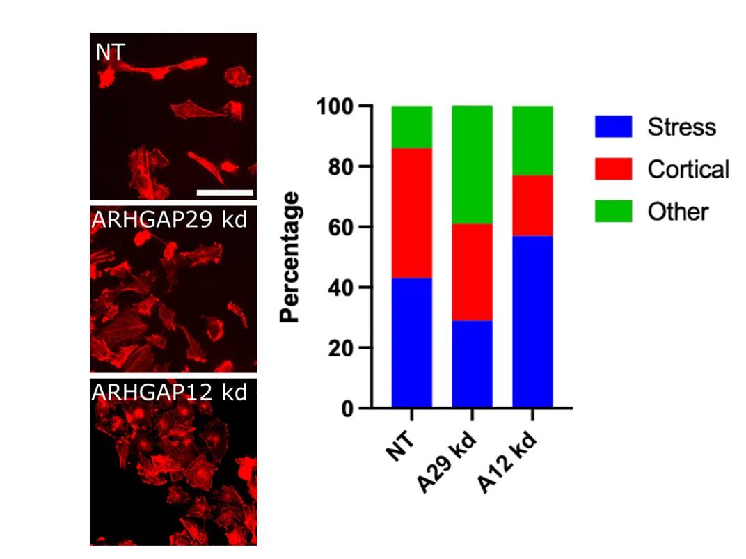 Open access visualization of Stacked Bar Plot, Microscopy, Photo, Immunofluorescence, U251 Cells