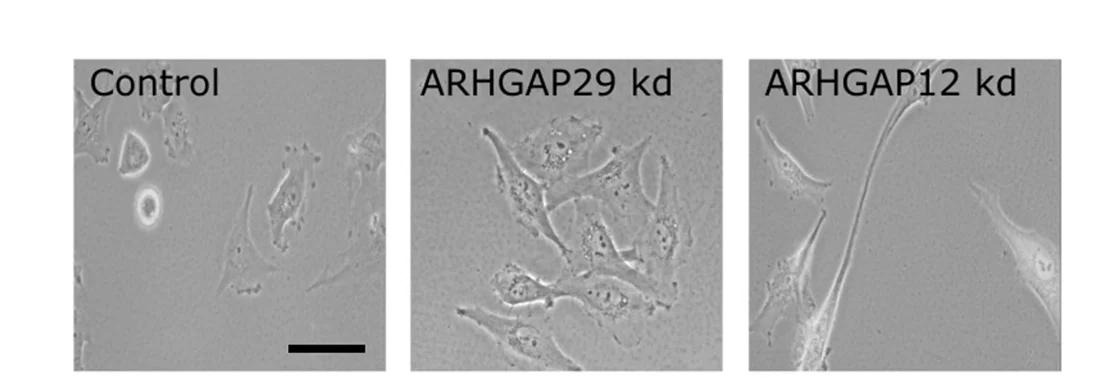 Open access visualization of Microscopy, Time-Lapse Microscopy, U251 Cells, ARHGAP12, ARHGAP29
