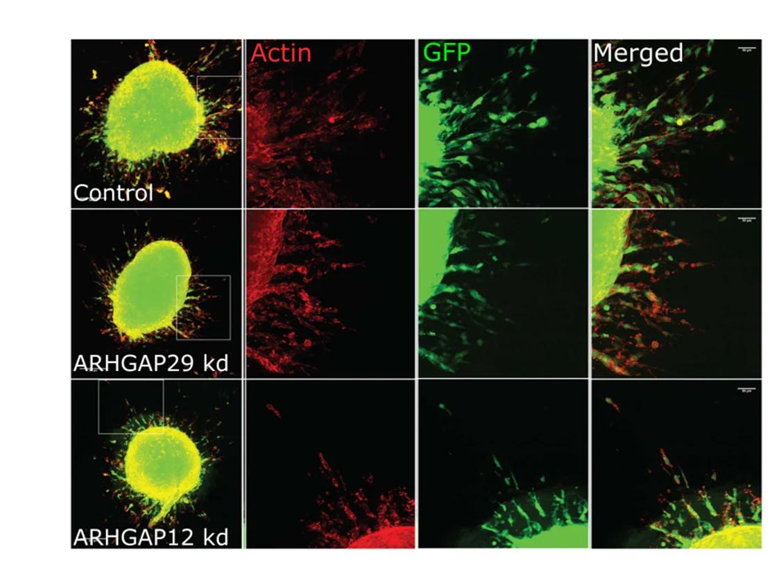 Open access visualization of Microscopy, 3D Spheroid Assay, ARHGAP29, Gene Knockdown, Cell Protrusions