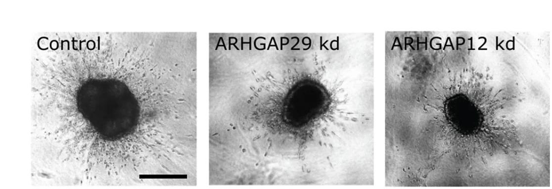 Open access visualization of Microscopy, 3D Invasion Assay, Cellular Features, Morphological Changes, Migrating Cells
