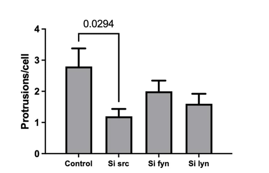 Open access visualization of Bar Plot, Error Bars, U251 Cells, Cell Morphology, ImageJ