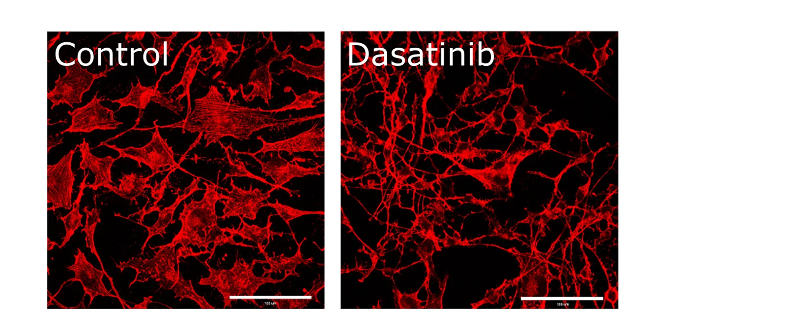 Open access visualization of Microscopy, Actin Relocalization, Src Kinase Inhibitor, Dasatinib