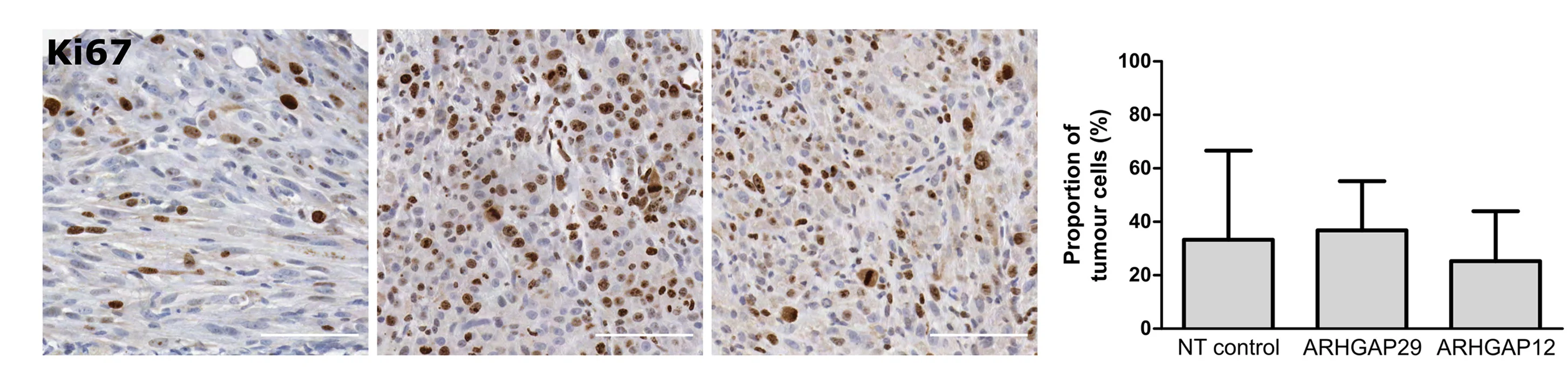 Open access visualization of Bar Plot, Error Bars, Microscopy, Photo, Mouse Brain Tissue