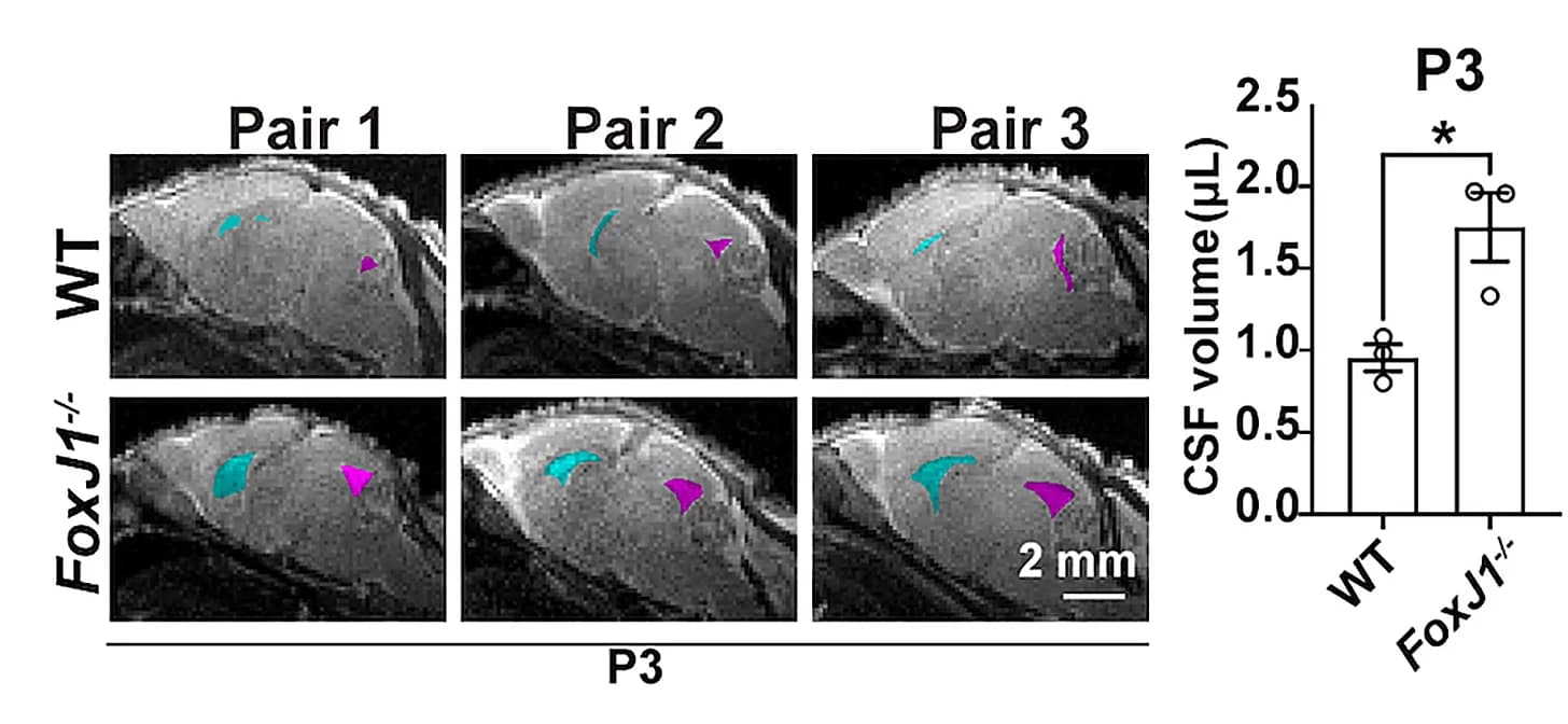 Open access visualization of Bar Plot, Photo, Microscopy, Magnetic Resonance Imaging, MRI