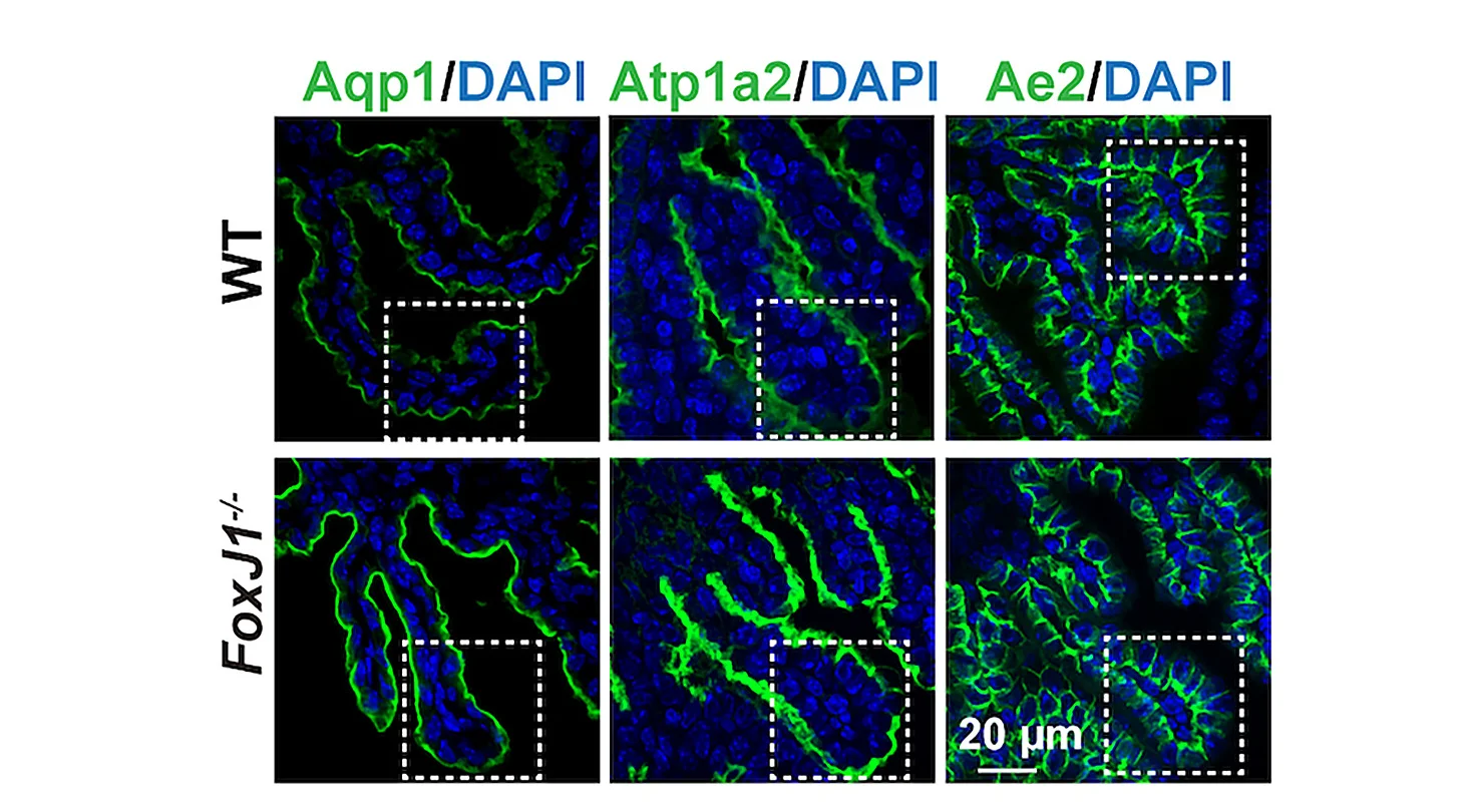 Open access visualization of Microscopy, Immunostaining, Paraffin Sections, Whole-Mount Tissue, Apical Aqp1