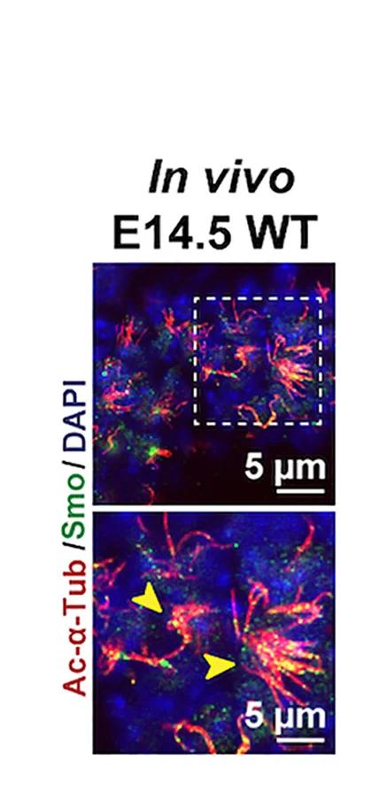 Open access visualization of Microscopy, Immunostaining, Smo, Cilia, Explant Culture