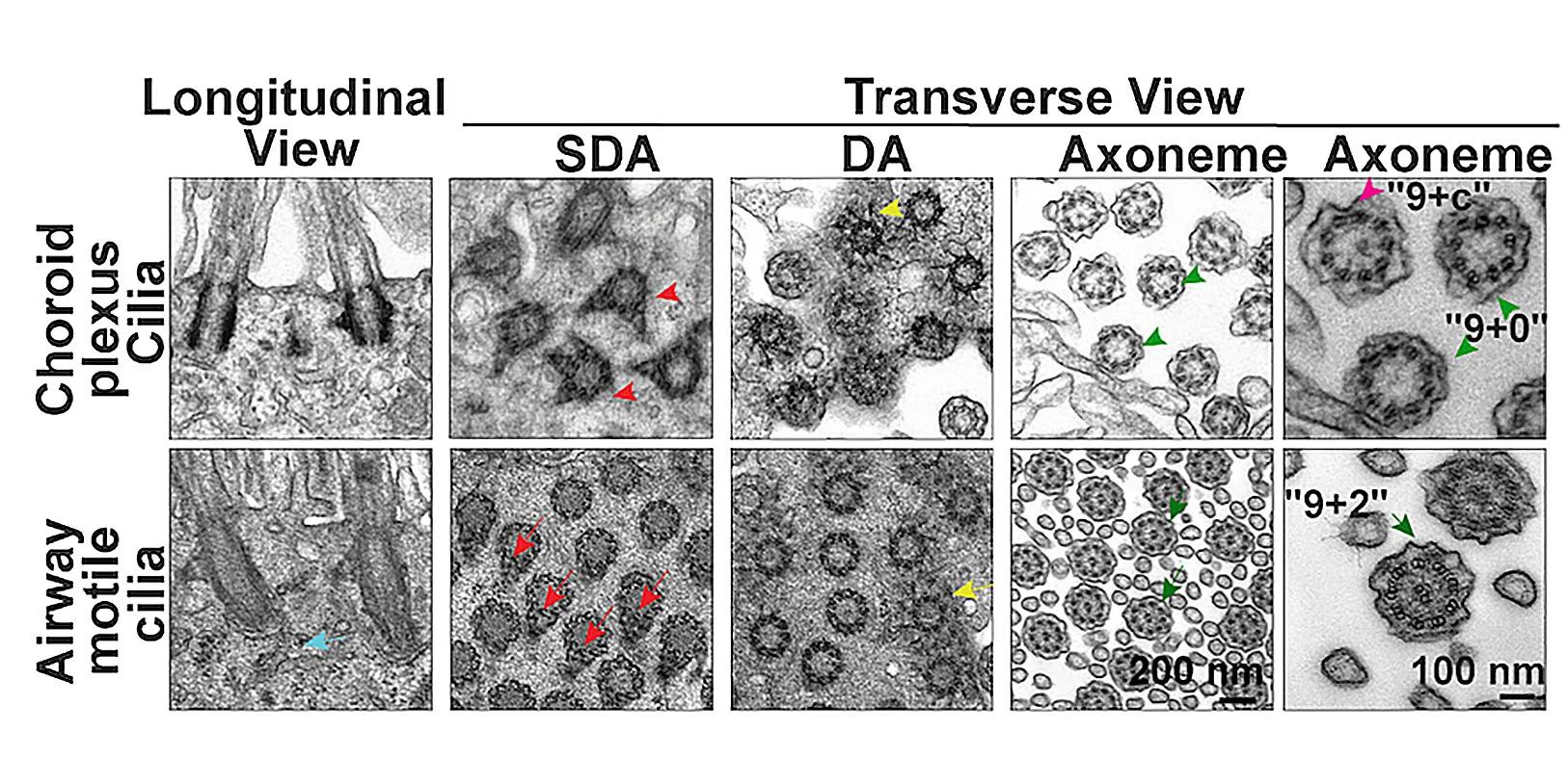 Open access visualization of Microscopy, Photo, TEM, Motile Cilia, Choroid Plexus Multicilia