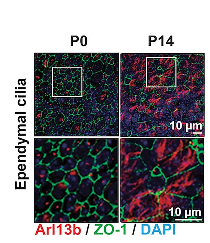 Open access visualization of Microscopy, Ependymal Cilia, Axonemes, Immunostaining, Apical Tight Junction