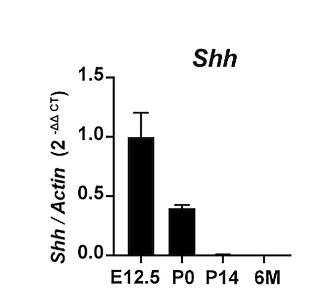 Open access visualization of Bar Plot, Error Bars, Real-time PCR, Shh mRNA Expression, Choroid Plexus