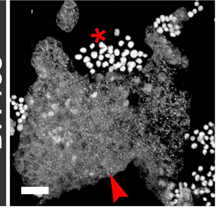Open access visualization of Microscopy, Knockdown, Notch, esgTS-FO, EEs