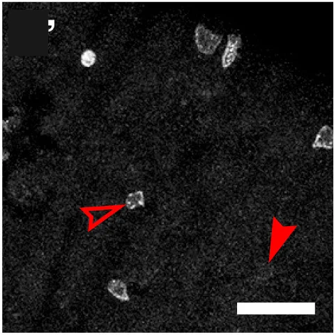 Open access visualization of Microscopy, Cell Composition, Clones, da10, emc RNAi