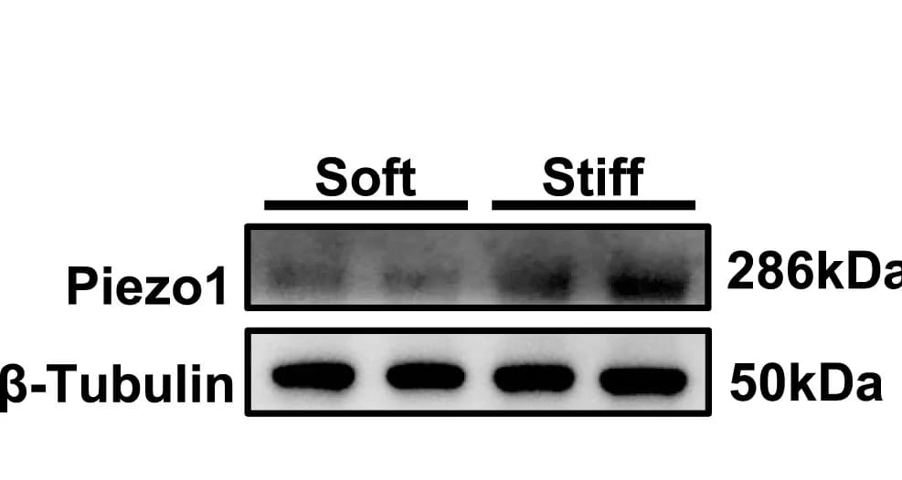 Open access visualization of Gel, Western Blot, Piezo1 Protein, Colonoids, Soft Matrices
