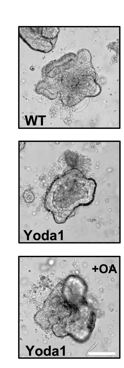 Open access visualization of Microscopy, Colonoids, WT Mouse, Yoda1 Mouse, OA Treatment