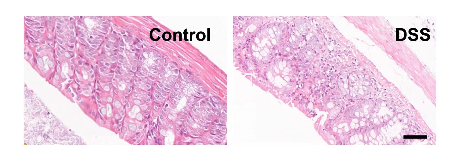 Open access visualization of Microscopy, H&E Staining, Colon Tissues, Control Mice, Chronic Colitis Mice