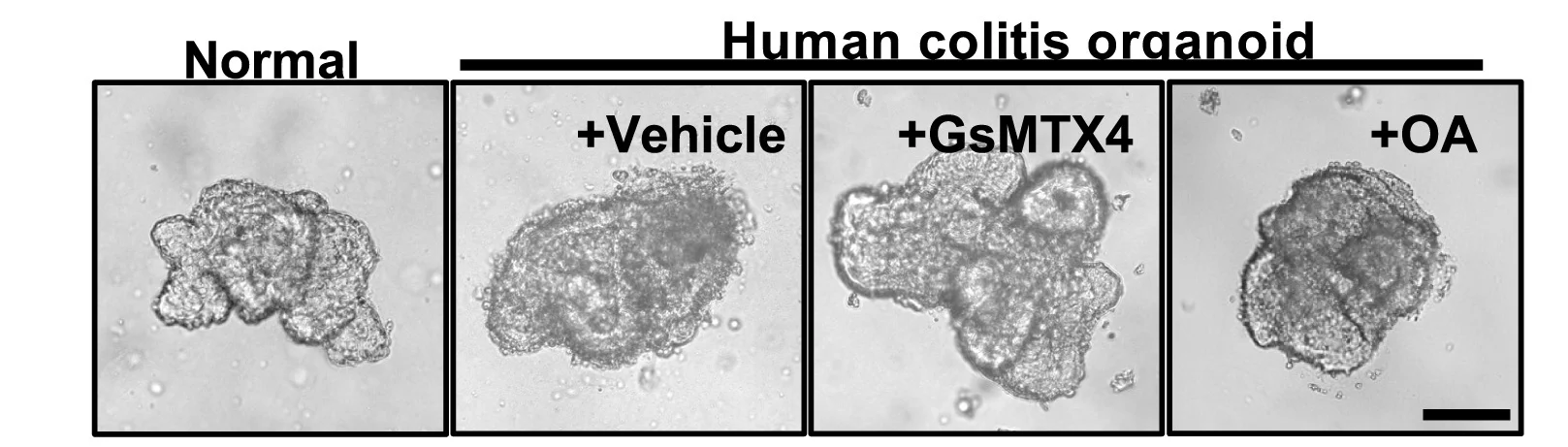 Open access visualization of Microscopy, Healthy Control Colonoids, UC Patient Colonoids, GsMTX4, OA